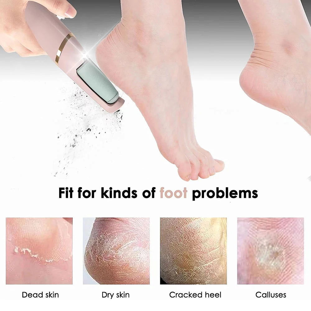 Electric Callus Remover ZADropship Electric_Callus_Remover_-_Goodie_hut_-_-4031721