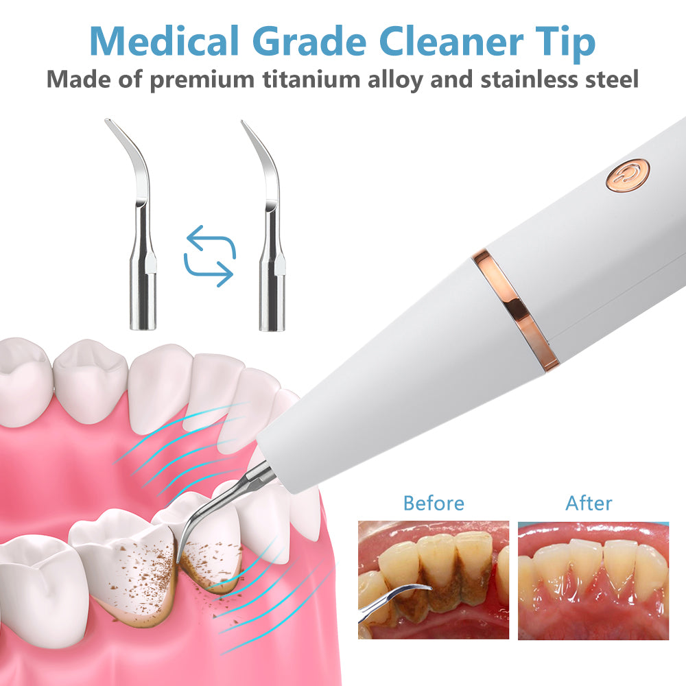 Electric Ultrasonic Dental Tooth Scalier