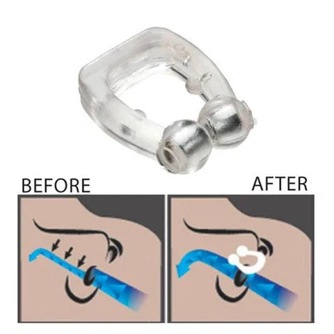 Snore Free Nose Clip